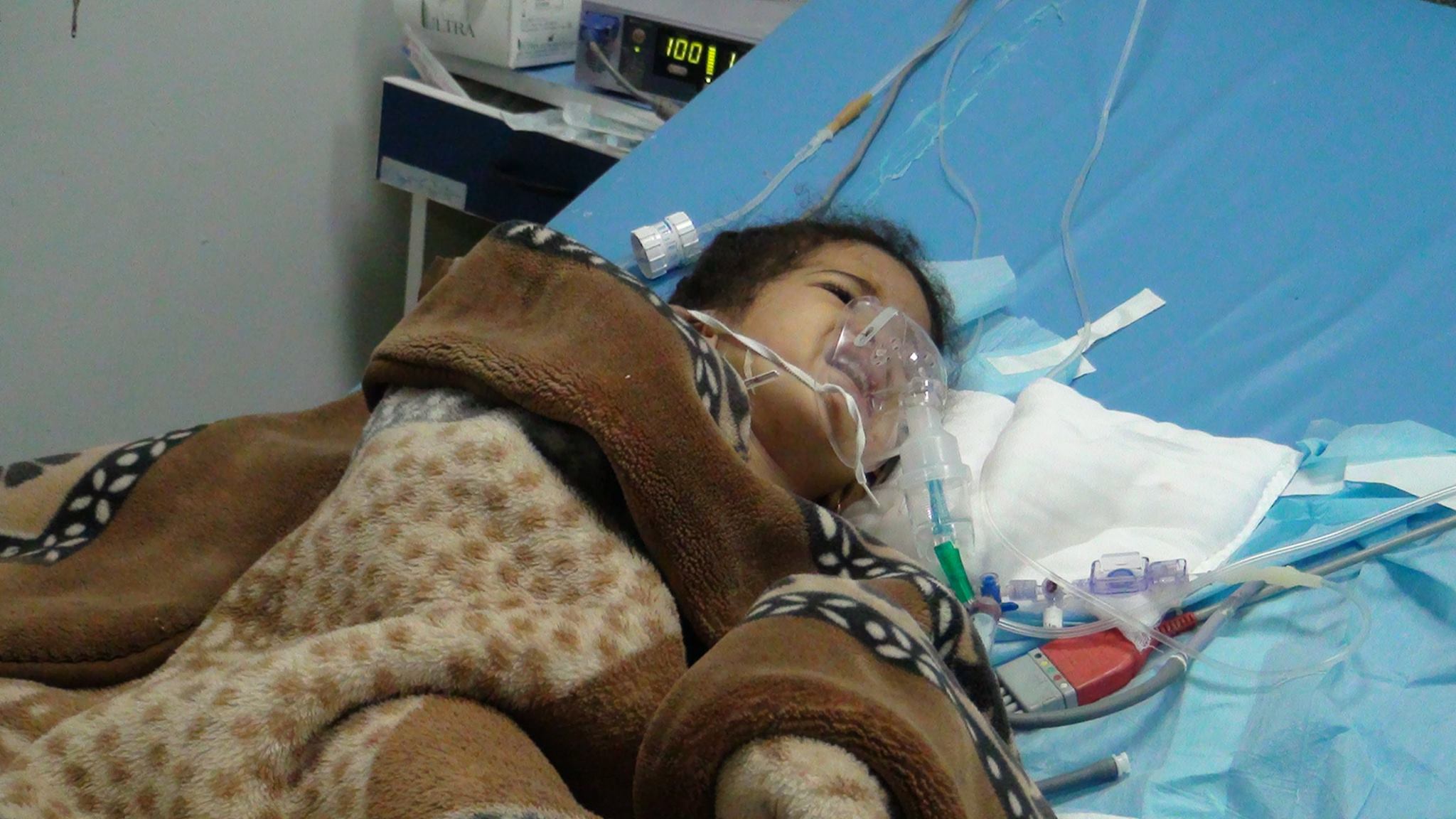 بالصور جامعي قنا تجرى 8 عمليات قلب مفتوح للأطفال مصر العربية
